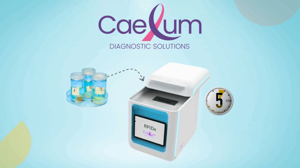 Caelum Diagnostic Solutions Scouted Interview